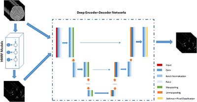 Unsupervised Cerebrovascular Segmentation of TOF-MRA Images Based on Deep Neural Network and Hidden Markov Random Field Model